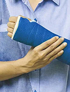 Dynamic Nova Cast Fiberglass Cast Tape