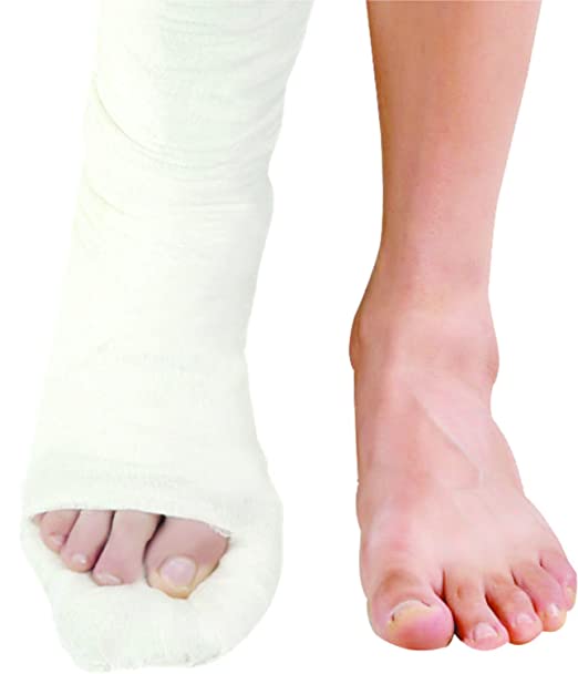 Dynamic Top Cast Plaster of Paris Bandage